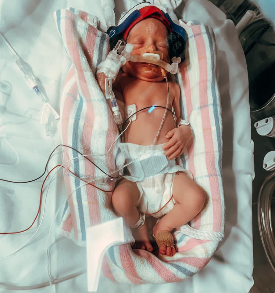 successful Twin VBAC