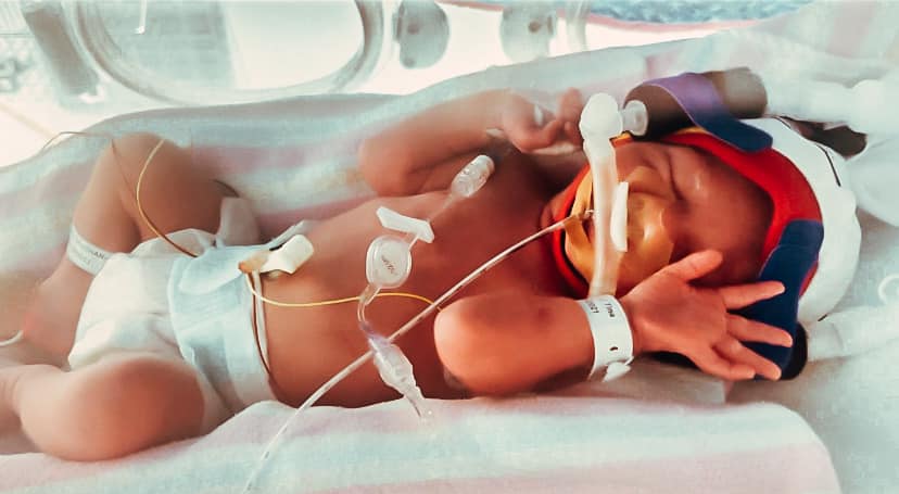 Successful twin VBAC